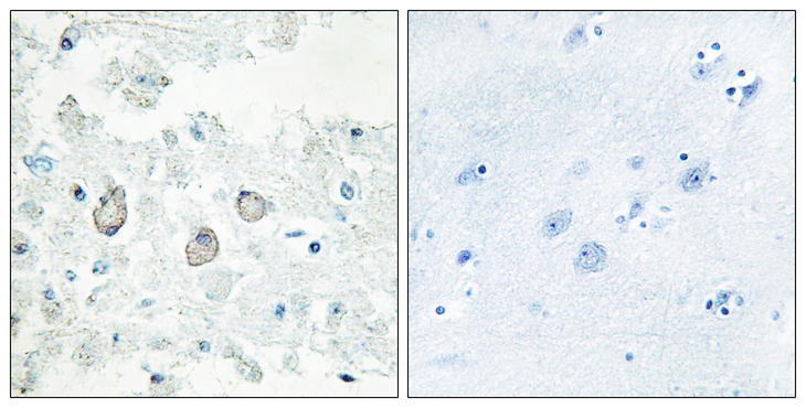 DOK7 Antibody - Immunohistochemistry analysis of paraffin-embedded human brain tissue, using DOK7 Antibody. The picture on the right is blocked with the synthesized peptide.