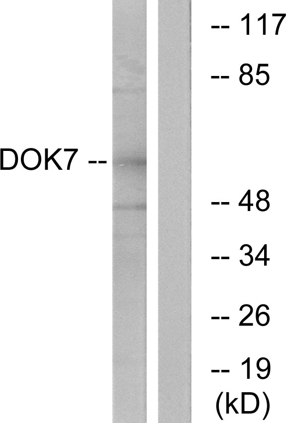 DOK7 Antibody - Western blot analysis of lysates from mouse brain, using DOK7 Antibody. The lane on the right is blocked with the synthesized peptide.