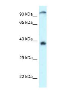 DOK7 Antibody - DOK7 antibody Western blot of Jurkat Cell lysate. Antibody concentration 1 ug/ml.  This image was taken for the unconjugated form of this product. Other forms have not been tested.