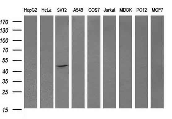 DOK7 Antibody - Western blot of extracts (35ug) from 9 different cell lines by using anti-DOK7 monoclonal antibody (HepG2: human; HeLa: human; SVT2: mouse; A549: human; COS7: monkey; Jurkat: human; MDCK: canine; PC12: rat; MCF7: human).