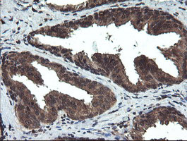 DOK7 Antibody - IHC of paraffin-embedded Human prostate tissue using anti-DOK7 mouse monoclonal antibody. (Heat-induced epitope retrieval by 10mM citric buffer, pH6.0, 100C for 10min).