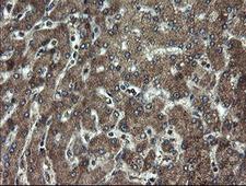DOK7 Antibody - IHC of paraffin-embedded Human liver tissue using anti-DOK7 mouse monoclonal antibody. (Heat-induced epitope retrieval by 10mM citric buffer, pH6.0, 100C for 10min).