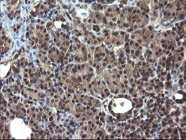 DOK7 Antibody - IHC of paraffin-embedded Human pancreas tissue using anti-DOK7 mouse monoclonal antibody. (Heat-induced epitope retrieval by 10mM citric buffer, pH6.0, 100C for 10min).