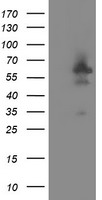 DOK7 Antibody - HEK293T cells were transfected with the pCMV6-ENTRY control (Left lane) or pCMV6-ENTRY DOK7 (Right lane) cDNA for 48 hrs and lysed. Equivalent amounts of cell lysates (5 ug per lane) were separated by SDS-PAGE and immunoblotted with anti-DOK7.