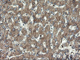 DOK7 Antibody - IHC of paraffin-embedded Human liver tissue using anti-DOK7 mouse monoclonal antibody. (Heat-induced epitope retrieval by 10mM citric buffer, pH6.0, 100C for 10min).