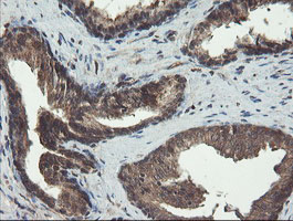 DOK7 Antibody - IHC of paraffin-embedded Human prostate tissue using anti-DOK7 mouse monoclonal antibody. (Heat-induced epitope retrieval by 10mM citric buffer, pH6.0, 100C for 10min).