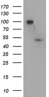 DOK7 Antibody - HEK293T cells were transfected with the pCMV6-ENTRY control (Left lane) or pCMV6-ENTRY DOK7 (Right lane) cDNA for 48 hrs and lysed. Equivalent amounts of cell lysates (5 ug per lane) were separated by SDS-PAGE and immunoblotted with anti-DOK7.