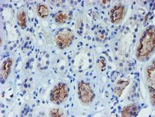 DOK7 Antibody - IHC of paraffin-embedded Human Kidney tissue using anti-DOK7 mouse monoclonal antibody.