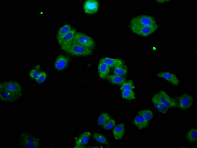 DOK7 Antibody - Immunofluorescence staining of HepG2 cells at a dilution of 1:133, counter-stained with DAPI. The cells were fixed in 4% formaldehyde, permeabilized using 0.2% Triton X-100 and blocked in 10% normal Goat Serum. The cells were then incubated with the antibody overnight at 4 °C.The secondary antibody was Alexa Fluor 488-congugated AffiniPure Goat Anti-Rabbit IgG (H+L) .