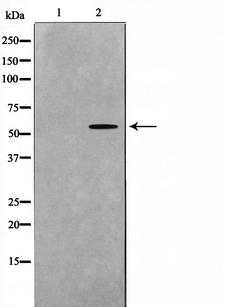 DOK7 Antibody - Western blot analysis on mouse brain cell lysates using DOK7 antibody. The lane on the left is treated with the antigen-specific peptide.