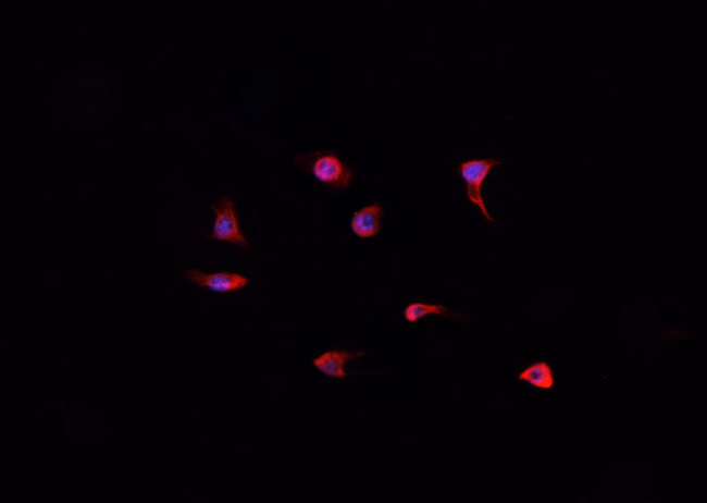 DOK7 Antibody - Staining A431 cells by IF/ICC. The samples were fixed with PFA and permeabilized in 0.1% Triton X-100, then blocked in 10% serum for 45 min at 25°C. The primary antibody was diluted at 1:200 and incubated with the sample for 1 hour at 37°C. An Alexa Fluor 594 conjugated goat anti-rabbit IgG (H+L) antibody, diluted at 1/600, was used as secondary antibody.