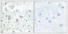 DOK7 Antibody - Peptide - + Immunohistochemistry analysis of paraffin-embedded human brain tissue using DOK7 antibody.