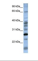 DOLPP1 Antibody - 721_B cell lysate. Antibody concentration: 1.0 ug/ml. Gel concentration: 12%.  This image was taken for the unconjugated form of this product. Other forms have not been tested.