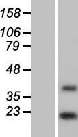 DOLPP1 Protein - Western validation with an anti-DDK antibody * L: Control HEK293 lysate R: Over-expression lysate