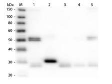 Rat IgG Antibody - Western Blot of Anti-Rat IgG (H&L) (DONKEY) Antibody (Min X Bv Ch Gt GP Ham Hs Hu Ms Rb & Sh Serum Proteins)  Lane M: 3 µl Molecular Ladder. Lane 1: Rat IgG whole molecule  Lane 2: Rat IgG F(c) Fragment  Lane 3: Rat IgG Fab Fragment  Lane 4: Rat IgM Whole Molecule  Lane 5: Rat Serum  All samples were reduced. Load: 50 ng per lane.