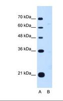 DONSON / B17 Antibody - Lane A: Marker. Lane B: HepG2 cell lysate. Antibody concentration: 1.0 ug/ml. Gel concentration: 12%.  This image was taken for the unconjugated form of this product. Other forms have not been tested.