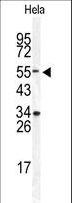 DONSON / B17 Antibody - Western blot of DONSON Antibody in HeLa cell line lysates (35 ug/lane). DONSON (arrow) was detected using the purified antibody.
