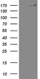 DOT1L / DOT1 Antibody - HEK293T cells were transfected with the pCMV6-ENTRY control (Left lane) or pCMV6-ENTRY DOT1L (Right lane) cDNA for 48 hrs and lysed. Equivalent amounts of cell lysates (5 ug per lane) were separated by SDS-PAGE and immunoblotted with anti-DOT1L.