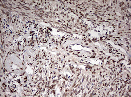 DOT1L / DOT1 Antibody - IHC of paraffin-embedded Human endometrium tissue using anti-DOT1L mouse monoclonal antibody. (Heat-induced epitope retrieval by 10mM citric buffer, pH6.0, 120°C for 3min).