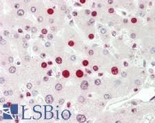 DOT1L / DOT1 Antibody - Human Liver: Formalin-Fixed, Paraffin-Embedded (FFPE)