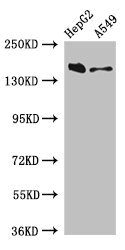 DOT1L / DOT1 Antibody - Western Blot Positive WB detected in:HepG2 whole cell lysate,A549 whole cell lysate All Lanes:DOT1L antibody at 3µg/ml Secondary Goat polyclonal to rabbit IgG at 1/50000 dilution Predicted band size: 185,165 KDa Observed band size: 185 KDa