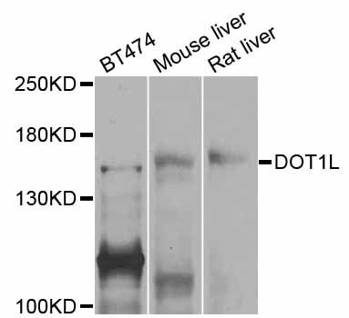 DOT1L / DOT1 Antibody - Western blot analysis of extracts of various cell lines, using DOT1L antibody at 1:1000 dilution. The secondary antibody used was an HRP Goat Anti-Rabbit IgG (H+L) at 1:10000 dilution. Lysates were loaded 25ug per lane and 3% nonfat dry milk in TBST was used for blocking. An ECL Kit was used for detection and the exposure time was 90s.