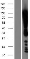 DOT1L / DOT1 Protein - Western validation with an anti-DDK antibody * L: Control HEK293 lysate R: Over-expression lysate