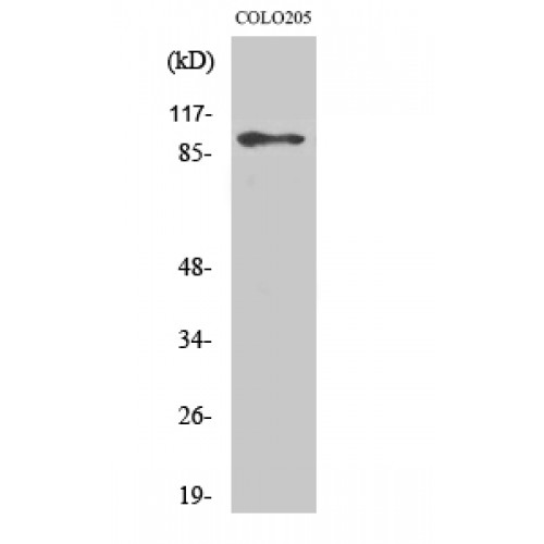 DP97 / DDX54 Antibody - Western blot of DDX54 antibody