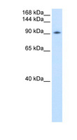 DP97 / DDX54 Antibody - DDX54 antibody ARP36498_P050-NP_076977-DDX54(DEAD (Asp-Glu-Ala-Asp) box polypeptide 54) Antibody Western blot of Transfected 293T cell lysate.  This image was taken for the unconjugated form of this product. Other forms have not been tested.