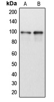 DP97 / DDX54 Antibody - Western blot analysis of DDX54 expression in HeLa (A); Jurkat (B) whole cell lysates.