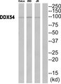 DP97 / DDX54 Antibody - Western blot of extracts from CoLo cells, 293 cells and Jurkat cells, using DDX54 antibody.