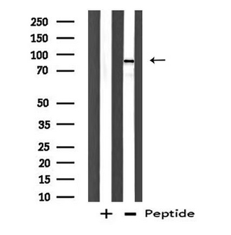 DP97 / DDX54 Antibody - Western blot analysis of extracts of COLO cells using DDX54 antibody.
