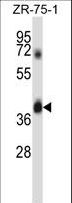 DPAGT2 / DPAGT1 Antibody - DPAGT1 Antibody western blot of ZR-75-1 cell line lysates (35 ug/lane). The DPAGT1 antibody detected the DPAGT1 protein (arrow).