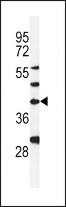 DPAGT2 / DPAGT1 Antibody - Western blot of DPAGT1 Antibody in MDA-MB231 cell line lysates (35 ug/lane). DPAGT1 (arrow) was detected using the purified antibody.