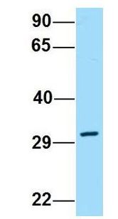 DPAGT2 / DPAGT1 Antibody - DPAGT2 / DPAGT1 antibody Western Blot of Human MCF7 lysate. Antibody Dilution: 1.0ug/ml. DPAGT1 is supported by BioGPS gene expression data to be expressed in MCF7. Antibody dilution: 1 ug/ml.  This image was taken for the unconjugated form of this product. Other forms have not been tested.