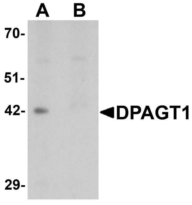 DPAGT2 / DPAGT1 Antibody - Western blot analysis of DPAGT1 in mouse kidney tissue lysate with DPAGT1 antibody at 1 ug/ml in (A) the absence and (B) the presence of blocking peptide.