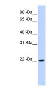 DPCD Antibody - DPCD antibody Western blot of HeLa lysate. This image was taken for the unconjugated form of this product. Other forms have not been tested.