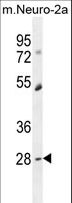 DPCD Antibody - RP11-529I10.4 Antibody western blot of mouse Neuro-2a cell line lysates (35 ug/lane). The RP11 antibody detected the RP11 protein (arrow).