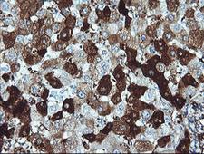 DPCD Antibody - IHC of paraffin-embedded Human liver tissue using anti-DPCD mouse monoclonal antibody.