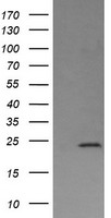 DPCD Antibody - HEK293T cells were transfected with the pCMV6-ENTRY control (Left lane) or pCMV6-ENTRY DPCD (Right lane) cDNA for 48 hrs and lysed. Equivalent amounts of cell lysates (5 ug per lane) were separated by SDS-PAGE and immunoblotted with anti-DPCD.