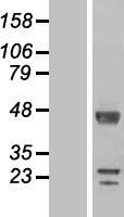 DPCD Protein - Western validation with an anti-DDK antibody * L: Control HEK293 lysate R: Over-expression lysate