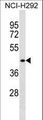 DPF1 / Neuro-D4 Antibody - DPF1 Antibody western blot of NCI-H292 cell line lysates (35 ug/lane). The DPF1 antibody detected the DPF1 protein (arrow).