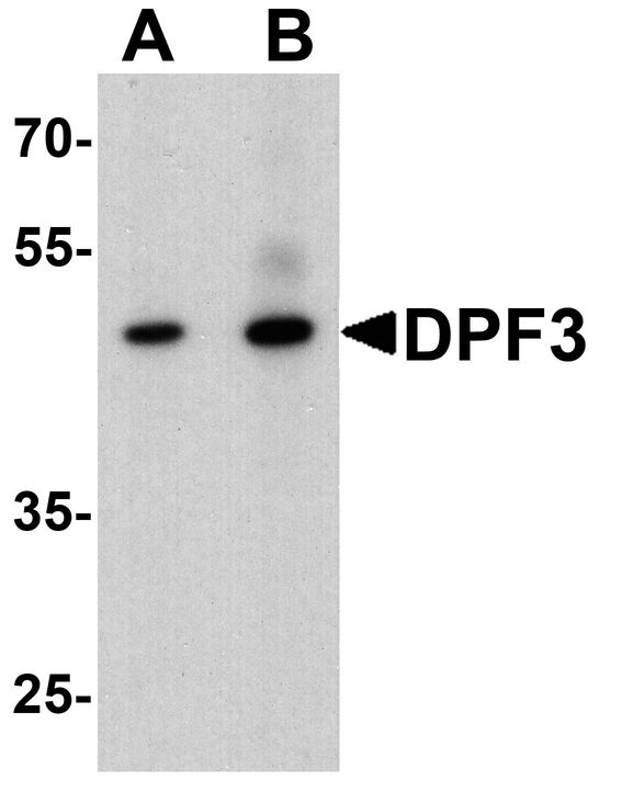 DPF3 Antibody - Western blot analysis of DPF3 in mouse brain tissue lysate with DPF3 antibody at (A) 1 and (B) 2 ug/ml.