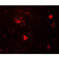 DPF3 Antibody - Immunofluorescence of DPF3 in human brain tissue with DPF3 antibody at 20 µg/mL.