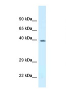 DPF3 Antibody - DPF3 antibody Western blot of Mouse Spleen lysate. Antibody concentration 1 ug/ml.  This image was taken for the unconjugated form of this product. Other forms have not been tested.