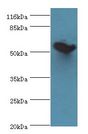 DPH2 Antibody - Western blot. All lanes: DPH2 antibody at 2 ug/ml+mouse brain tissue. Secondary antibody: Goat polyclonal to rabbit at 1:10000 dilution. Predicted band size: 52 kDa. Observed band size: 52 kDa.  This image was taken for the unconjugated form of this product. Other forms have not been tested.