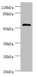 DPH2 Antibody - Western blot All lanes: DPH2 antibody at 2µg/ml + Mouse brain tissue Secondary Goat polyclonal to rabbit IgG at 1/10000 dilution Predicted band size: 53, 28, 39 kDa Observed band size: 53 kDa