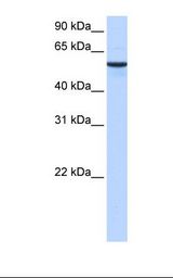 DPH2 Antibody - Muscle cell lysate. Antibody concentration: 0.5 ug/ml. Gel concentration: 12%.  This image was taken for the unconjugated form of this product. Other forms have not been tested.