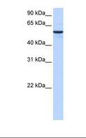 DPH2 Antibody - Muscle cell lysate. Antibody concentration: 0.5 ug/ml. Gel concentration: 12%.  This image was taken for the unconjugated form of this product. Other forms have not been tested.