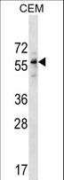 DPH2 Antibody - DPH2 Antibody western blot of CEM cell line lysates (35 ug/lane). The DPH2 antibody detected the DPH2 protein (arrow).